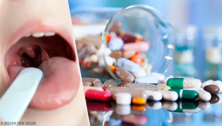 Tratamiento para la amigdalitis aguda