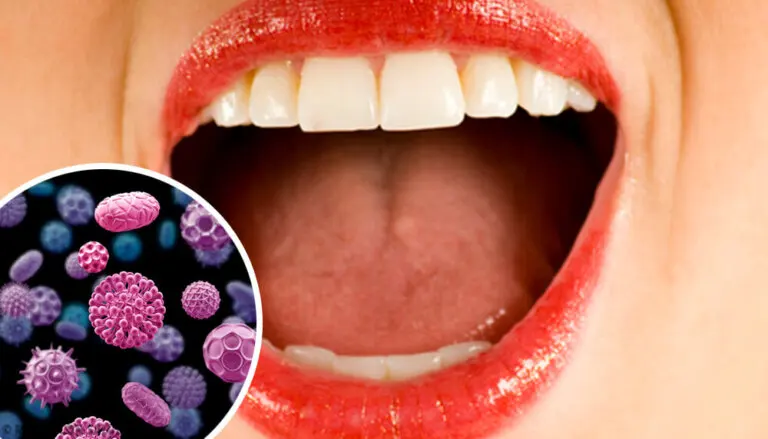 Tumor de Abrikossoff