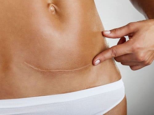 Problemas de cicatrización cuando tu cuerpo no está bien