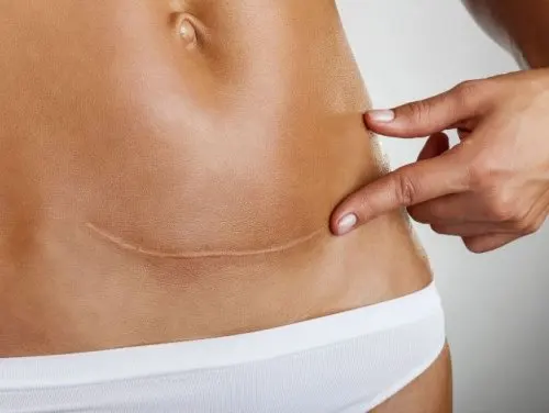 Problemas de cicatrización cuando tu cuerpo no está bien