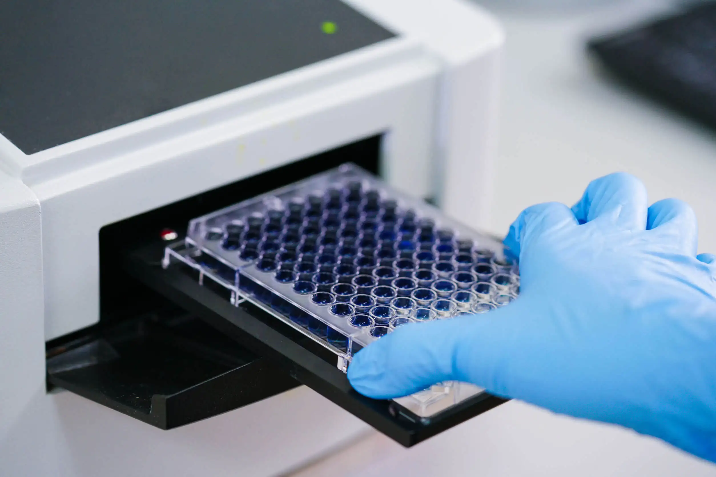Prueba de laboratorio para anticuerpos antinucleares.