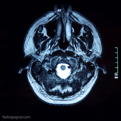 Gif de un cerebro