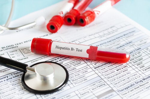 Hepatitis B
