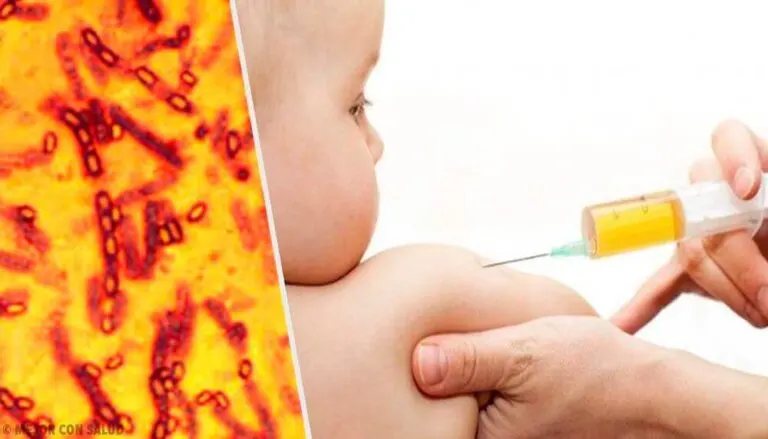 Tratamiento del carbunco