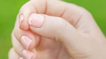 8 razones por las que tienes uñas quebradizas