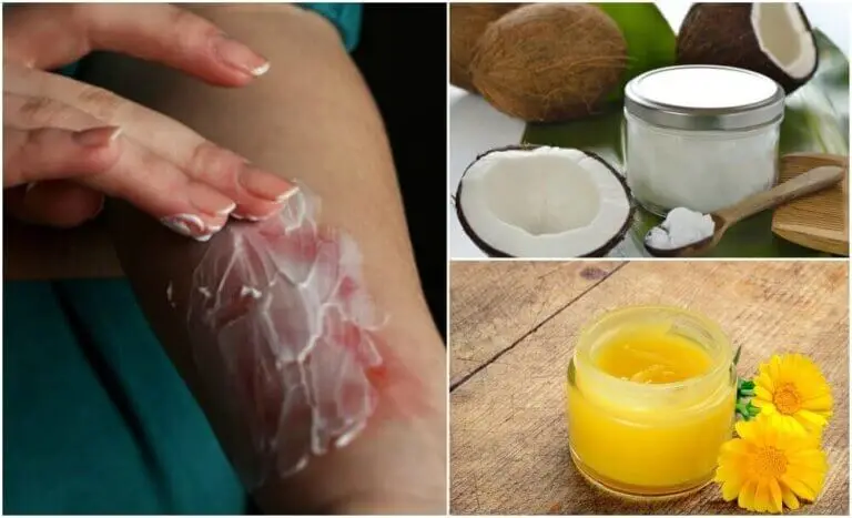 3 ungüentos antisépticos para el tratamiento de heridas superficiales