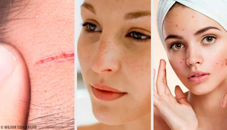 Los problemas más frecuentes del rostro y cómo tratarlos