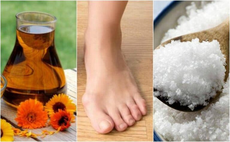 4 soluciones naturales para reducir los juanetes