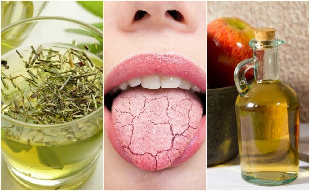 5 remedios caseros para aliviar la boca seca