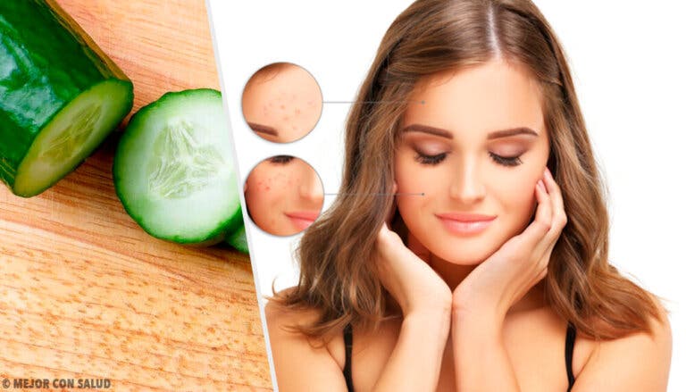 Tónicos caseros para controlar el cutis graso