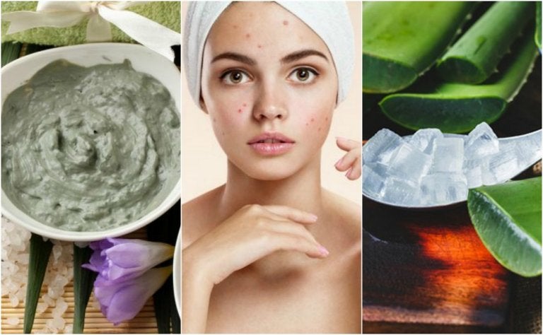 5 tratamientos de origen natural para los granos de la cara