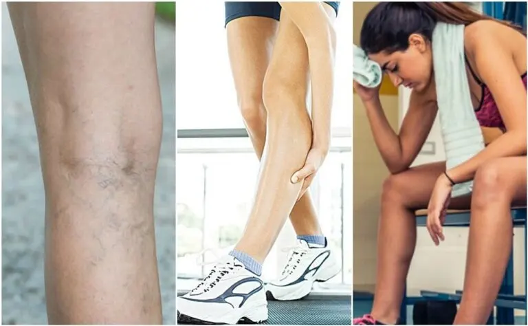 6 cosas que te pueden estar causando calambres