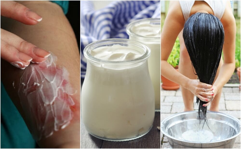 6 formas de utilizar yogur natural como remedio casero