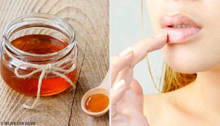 6 remedios naturales para las grietas labiales