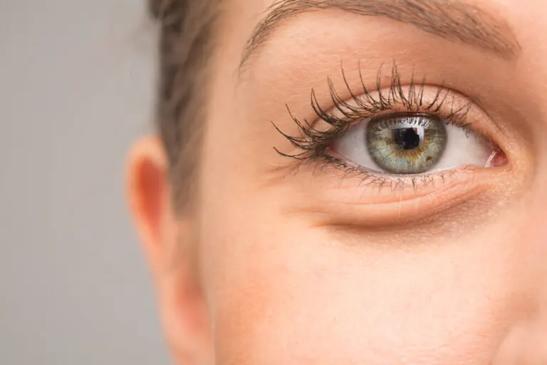 7 razones por las que se pueden hinchar los ojos