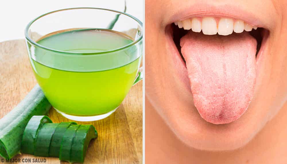 7 remedios naturales para la lengua blanca