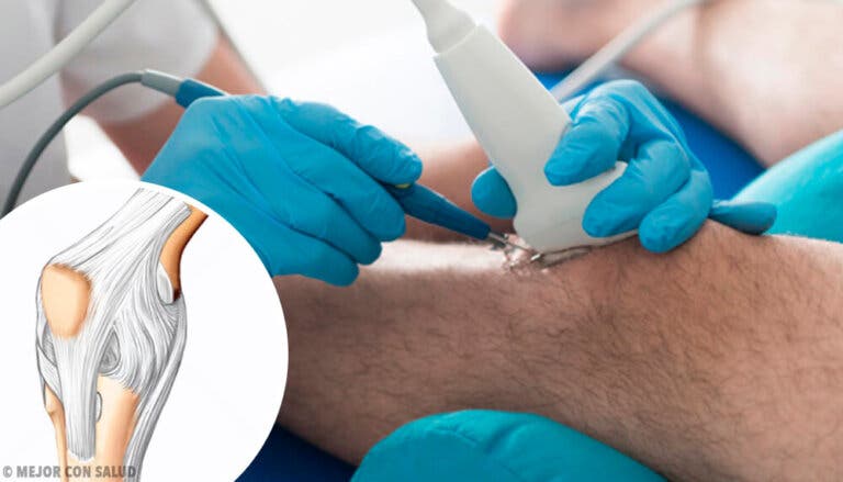 Articulación de la rodilla