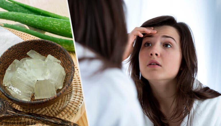 Cómo usar el aloe vera para reducir las arrugas
