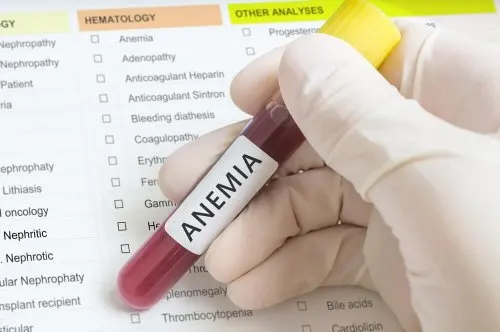 Anemia