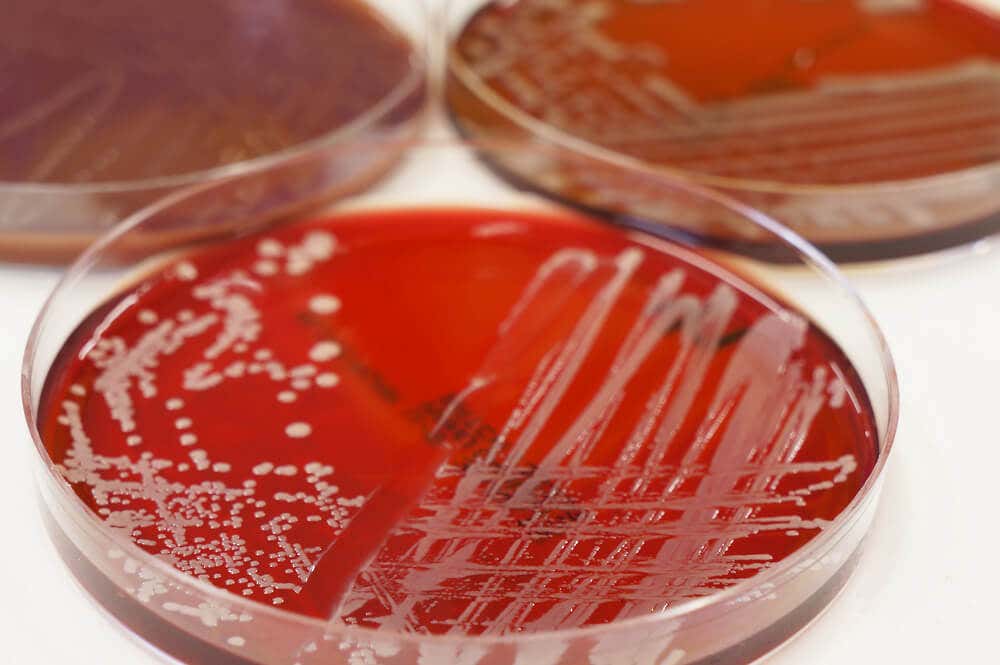 Cómo se sabe se si trata de una bacteria gram+ o gram- Bacitracina