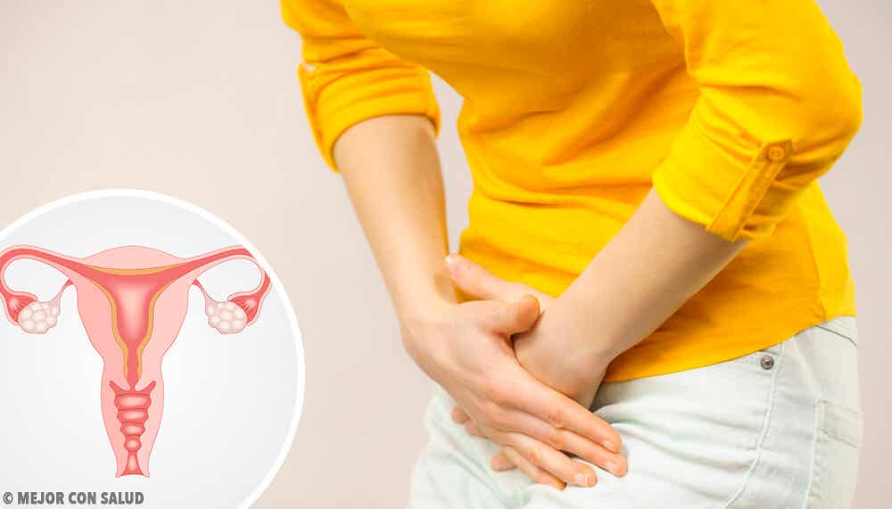 Mujer tocándose el abdomen por el dolor que le provoca el síndrome del ovario poliquístico