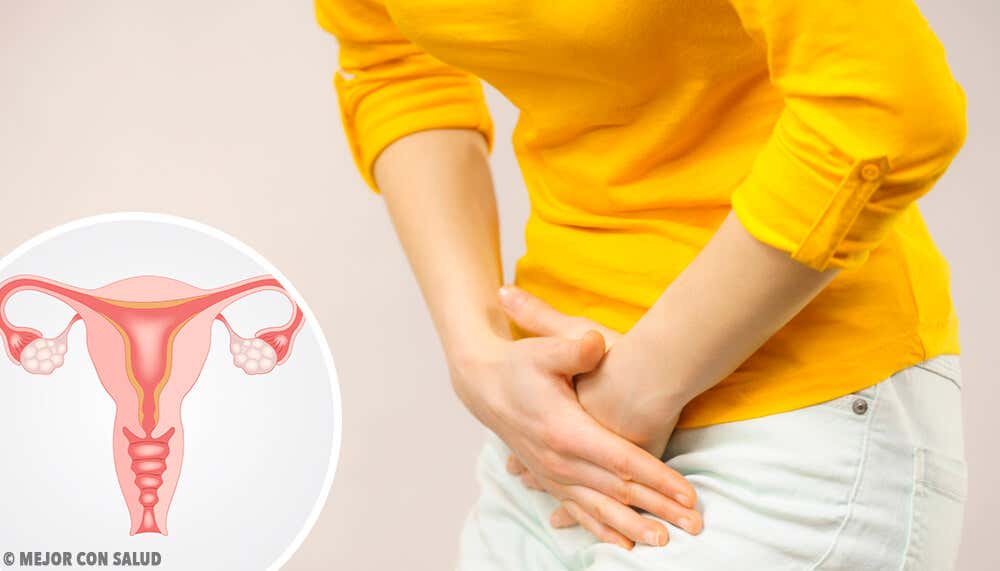 Mujer tocándose el abdomen por el dolor que le provoca el síndrome del ovario poliquístico
