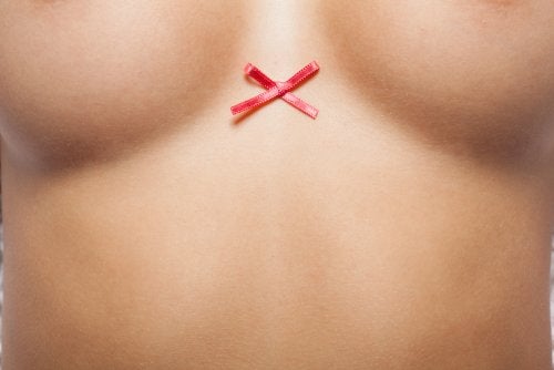 Efectos secundarios de mastectomía.