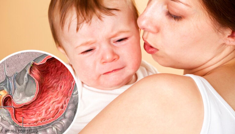 Estenosis pilórica: síntomas y tratamiento