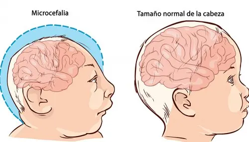 Factores de riesgo