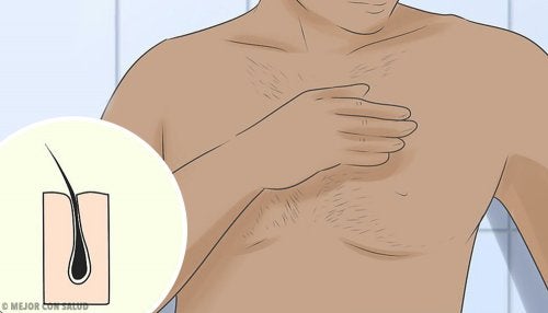 ¿Qué es la foliculitis? ¿Por qué se produce y cómo se trata?
