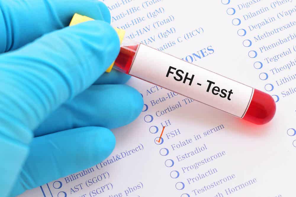 La prueba de FHS: análisis de sangre para determinar la cantidad de hormona estimuladora del folículo.