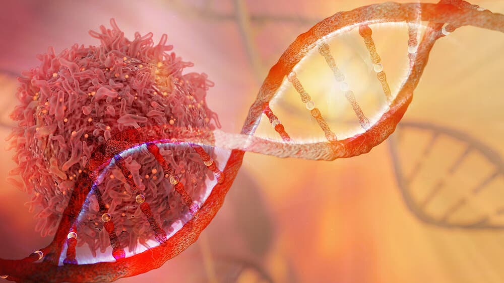 Pronóstico de la micosis fungoide