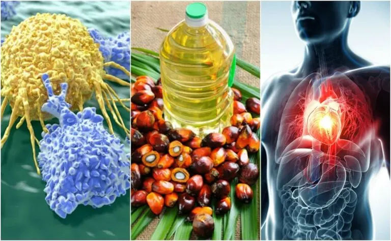 Razones por las que el aceite de palma es malo para la salud
