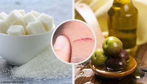 Recetas caseras para ayudar a reducir cicatrices