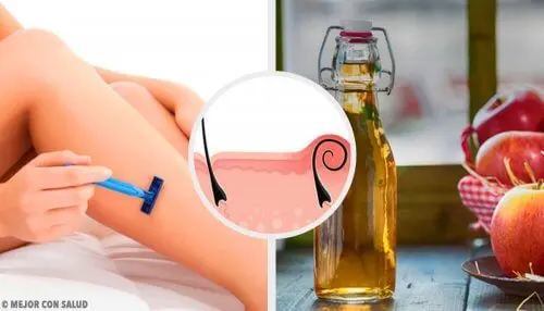 5 remedios naturales para tratar la pseudofoliculitis