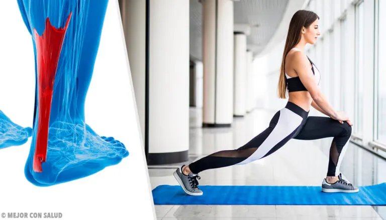 Tendinitis: tipos y tratamiento