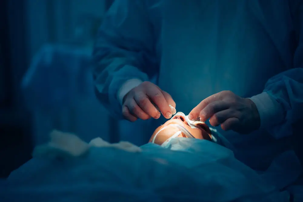 Rinoplastia que requiere rinomodelación.