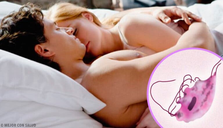 Tricomoniasis: signos, síntomas y tratamiento en hombres y mujeres
