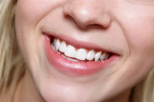 Mujer con una sonrisa blanca.