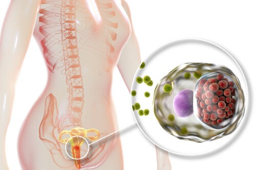 Clamidiasis: qué es y en qué consiste