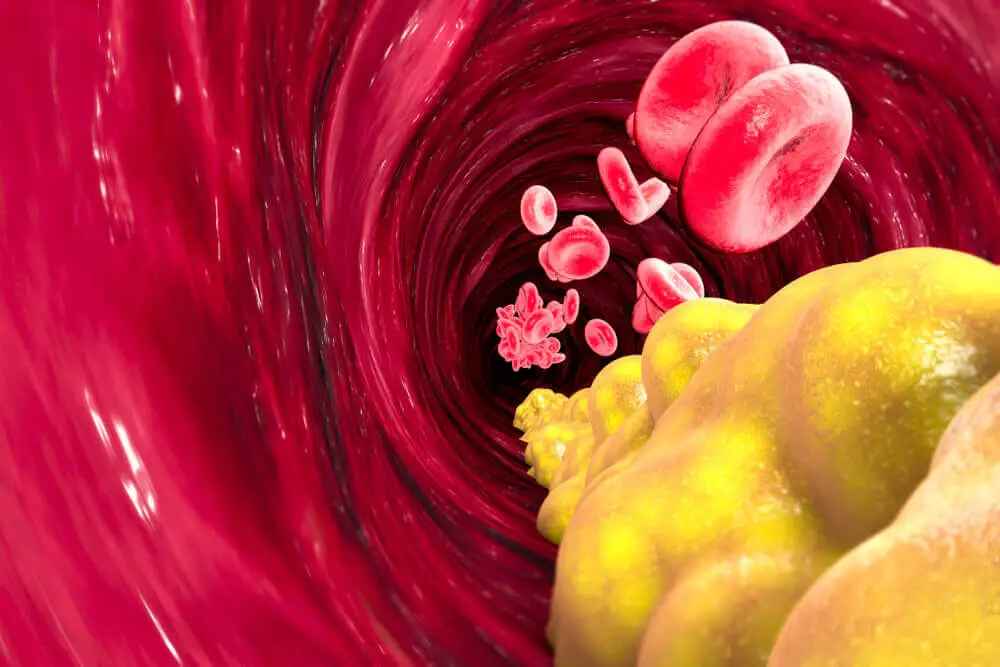 La tensión arterial alta puede afectar la salud arterial