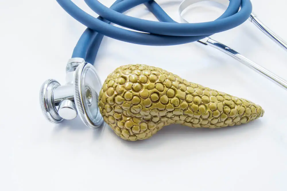 Pancreatitis por alcoholismo crónico.