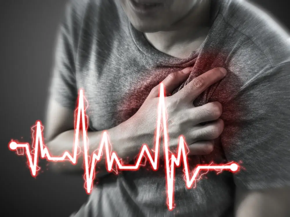 infarto agudo de miocardio