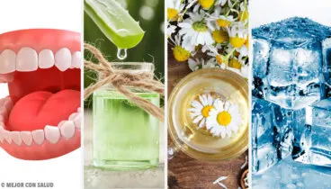 ¿Qué hacer al sufrir una quemadura en el paladar?