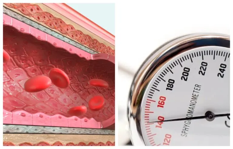 Sistema renina angiotensina-aldosterona