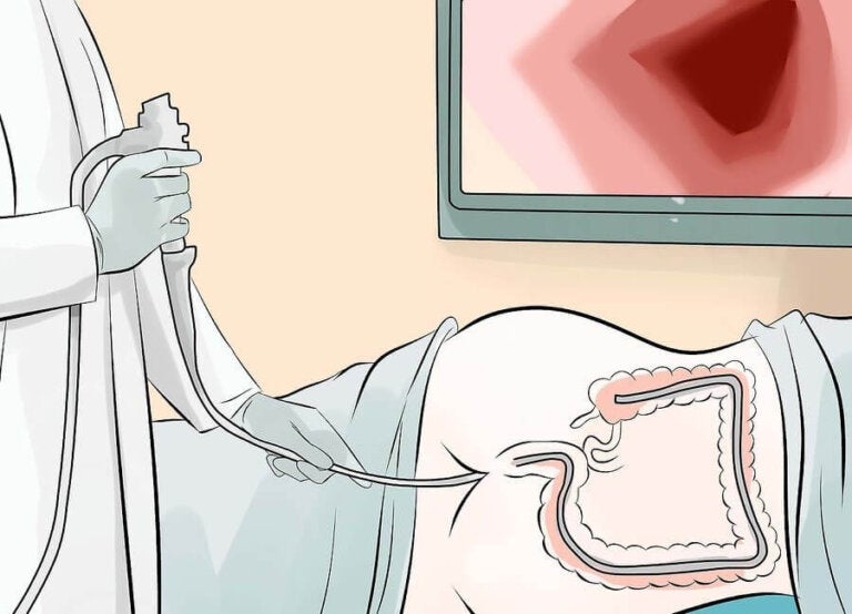 ¿Para qué se practica una colonoscopia?