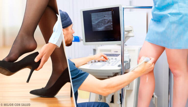 3 remedios naturales para olvidarte de las varices rápidamente