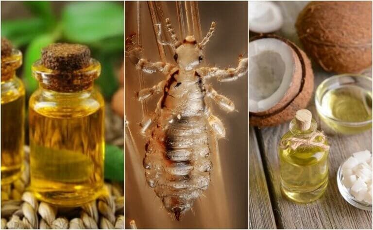 Cómo hacer 5 remedios caseros para deshacerte de los piojos y liendres