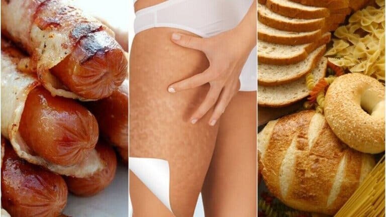 6 alimentos que empeoran la celulitis