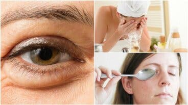 Consejos para reducir las bolsas de los ojos